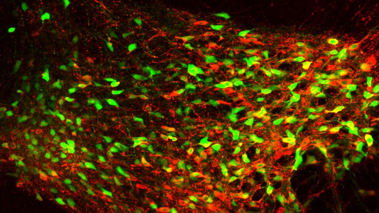 Image of VTA neurons