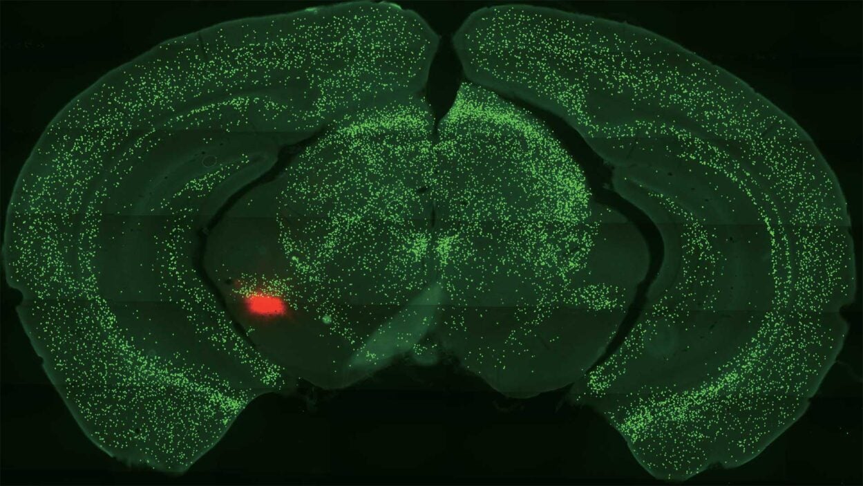 Image of a mouse midbrain dopamine region