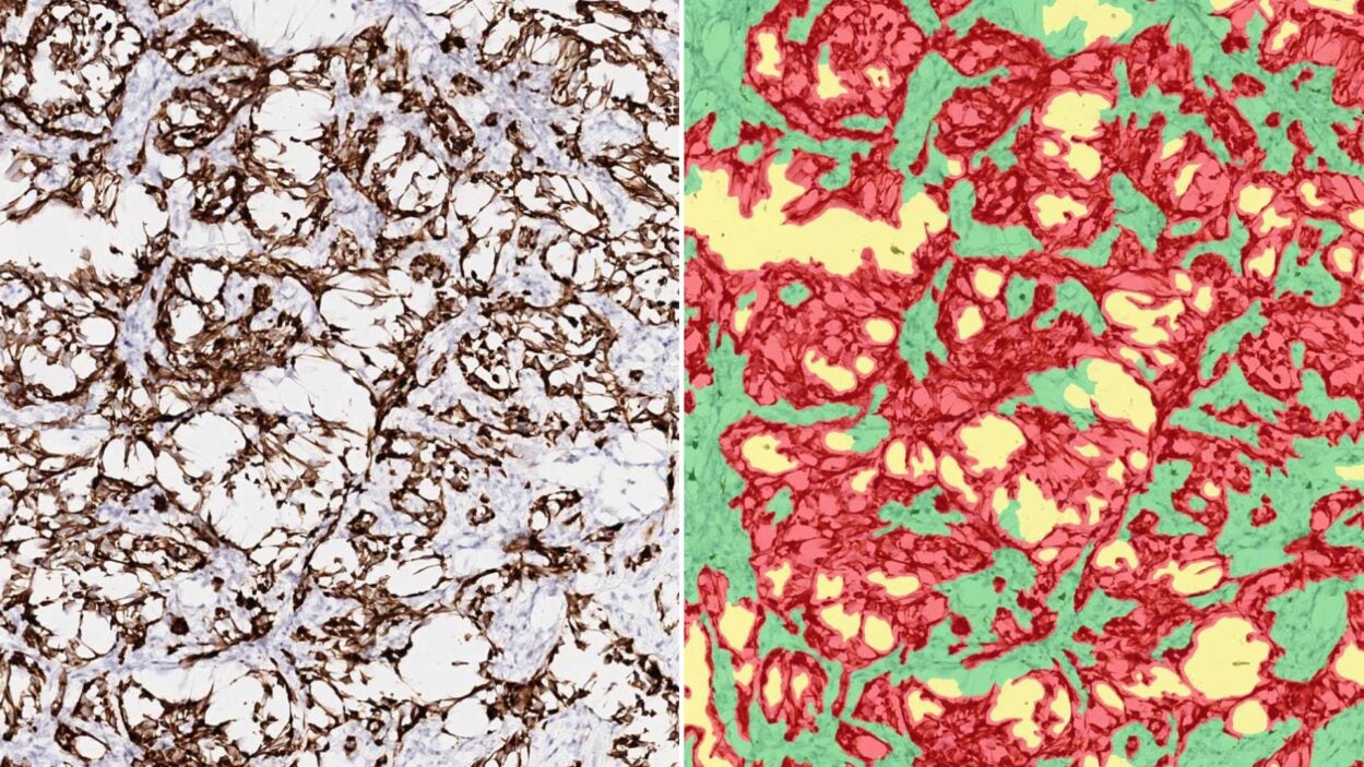 Images of mouse tumors with colorized cancer cells